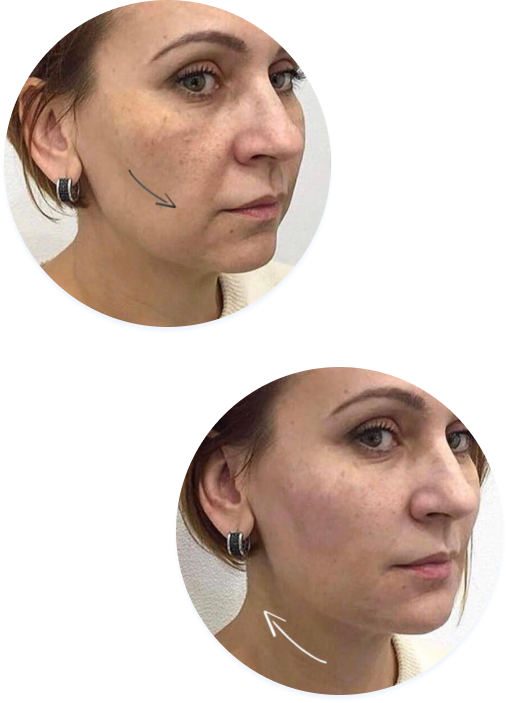 Results before and after procedures